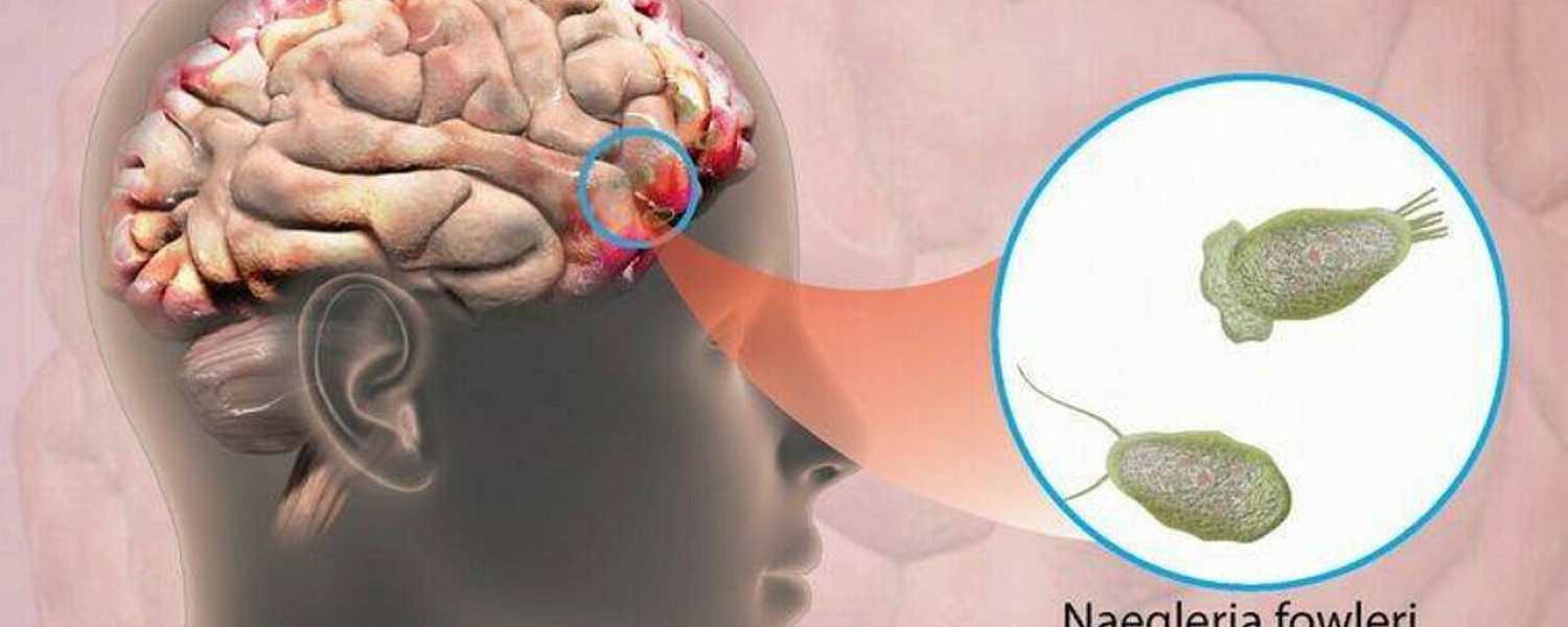 В Израиле мужчина искупался в озере и заразился поедающей мозг амебой